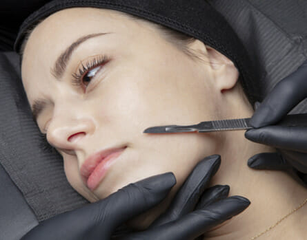 Mechanical exfoliation, like microdermabrasion, keeps skin clear of dead skin buildup.