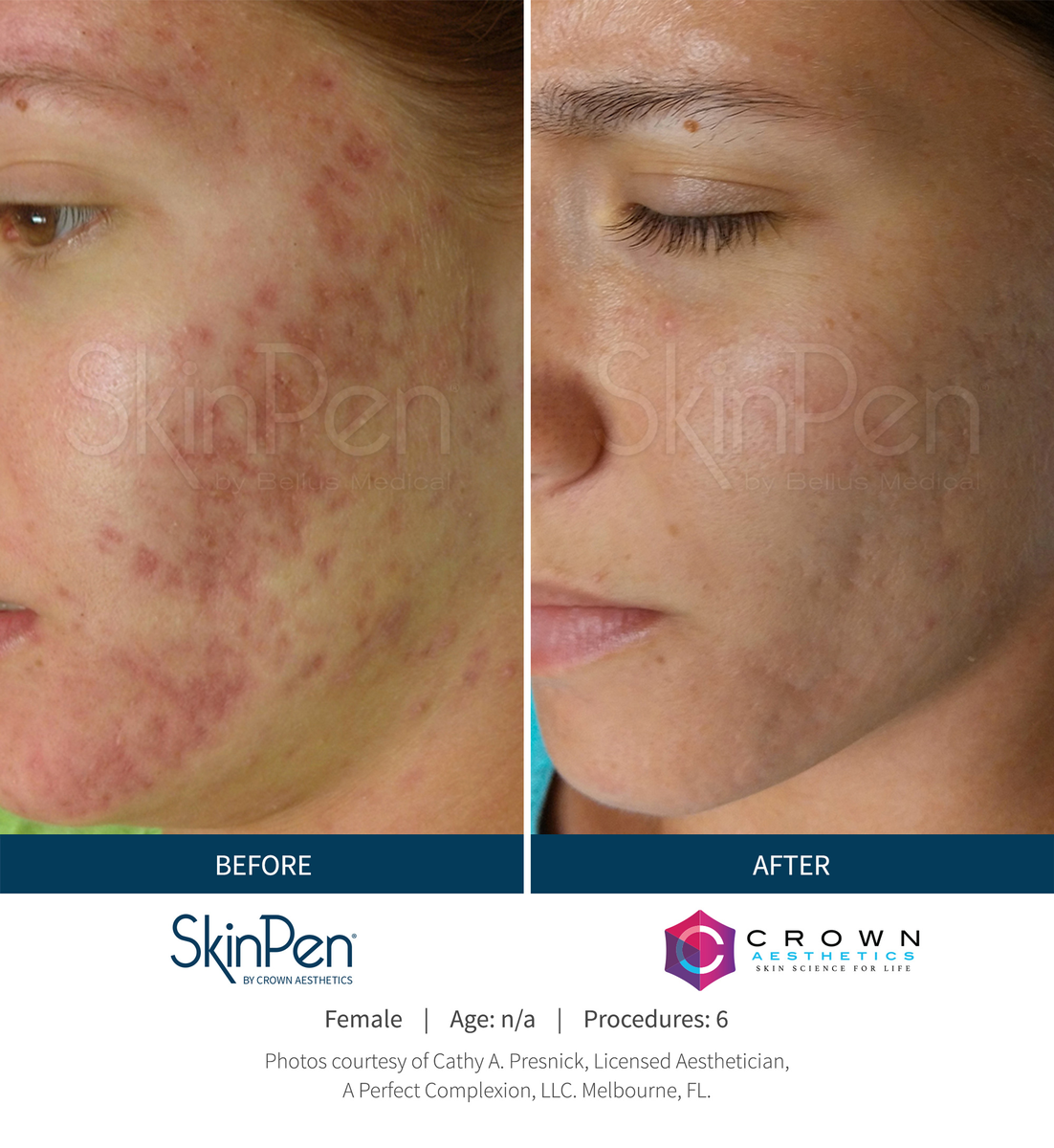 Before-and-After-Picture-CA-17_maxWidth_1200_maxHeight_1200_ppi_72